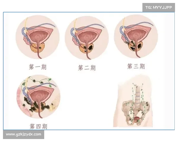Woj:莫宁成功接受前列腺癌切除手术,病情未扩散 Woj:莫宁成功接受前列腺癌切除手术,病情未扩散